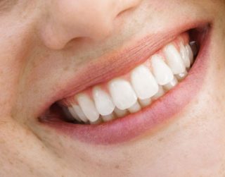 Estética dental
